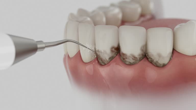 Reliable Teeth Whitening contractor in Montgomery County County, AR by Dentist Open Now
